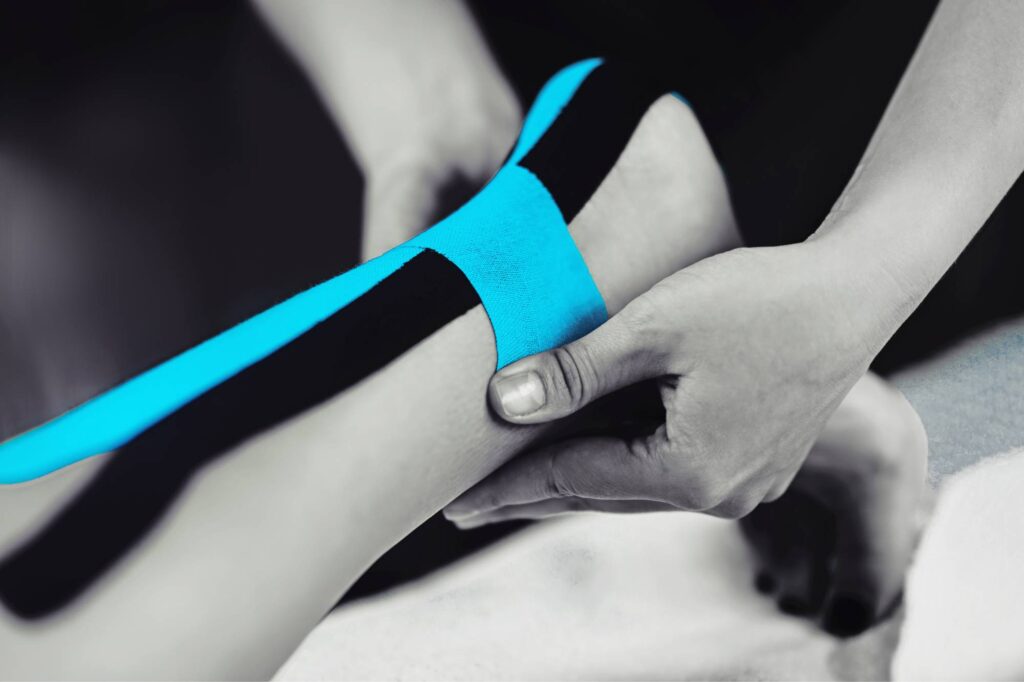 Qué es y qué beneficios tiene la terapia de kinesiotaping